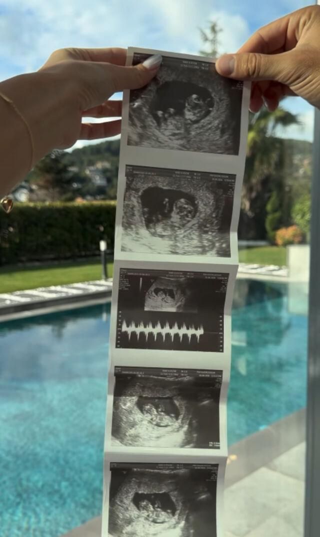 Asensio'dan Aile Büyüyor Paylaşımı-1